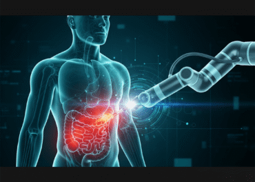 קוליטיס כיבית